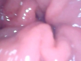 Inside my anal pussy view